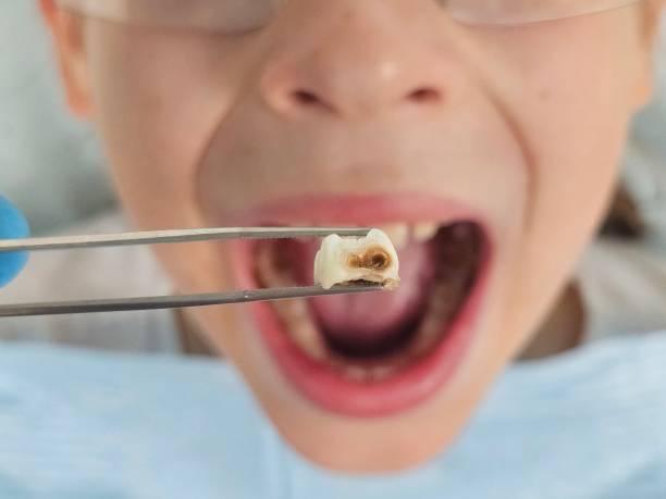 Best Walk-In Emergency Dental Services in Pine, AZ